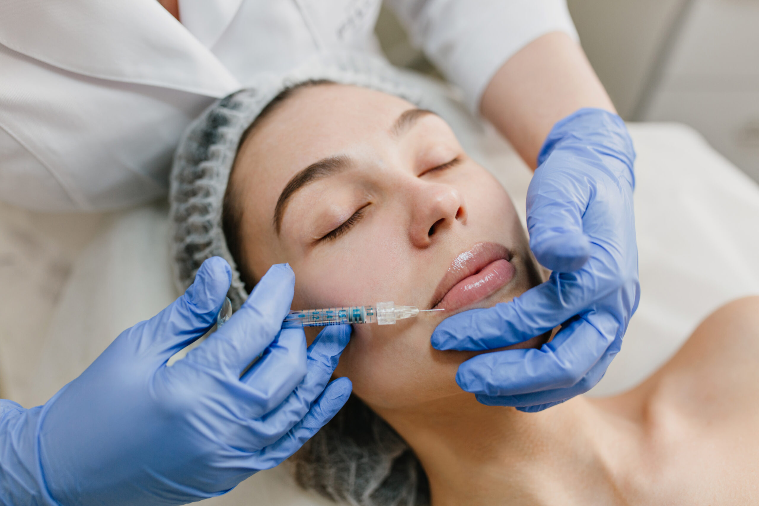 Lip Fillers Injections treatment in Sacramento CA
