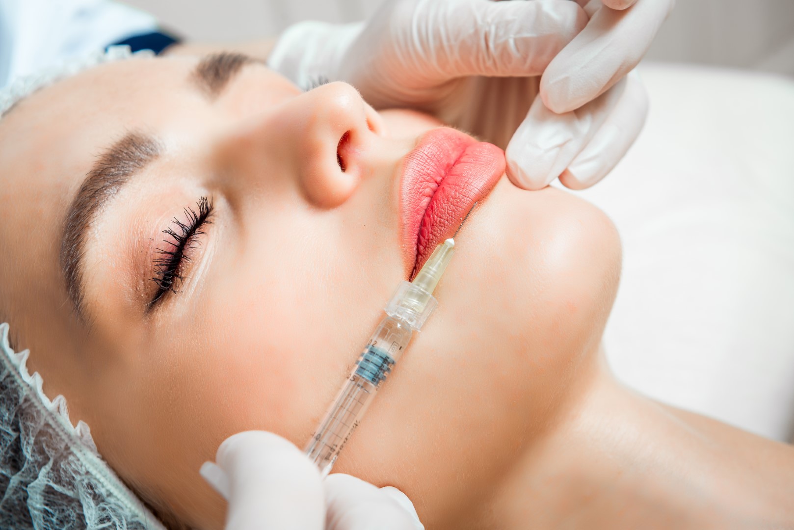 Lip Fillers, Injection treatment in Sacramento CA
