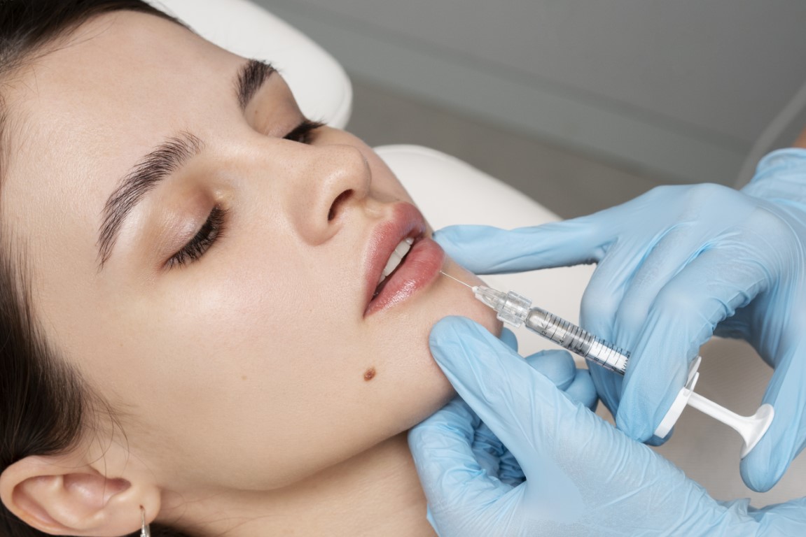 BOTOX® - Lip Fillers, Injection treatment