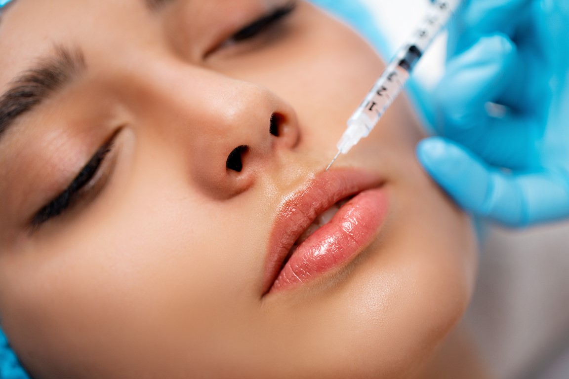 Lip Fillers treatment
